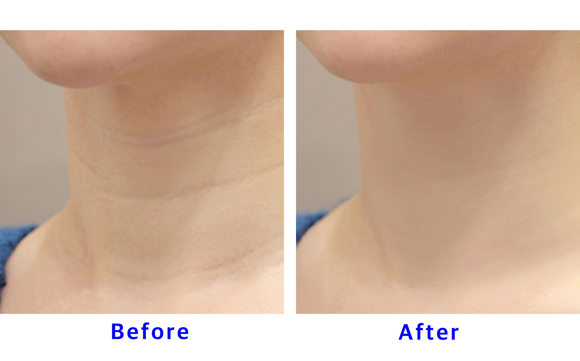 Lienjang Hongdae Discount Coupon